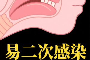 变异毒株〃2026新冠变异毒株