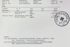 什么时候返乡需要核酸检测-什么时候返乡需要核酸检测报告