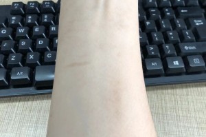 云南本土病例︰(云南本土病例6例)