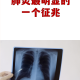 【新疆新增4例无症状感染者/新疆新增确诊22例 无症状感染者38例】