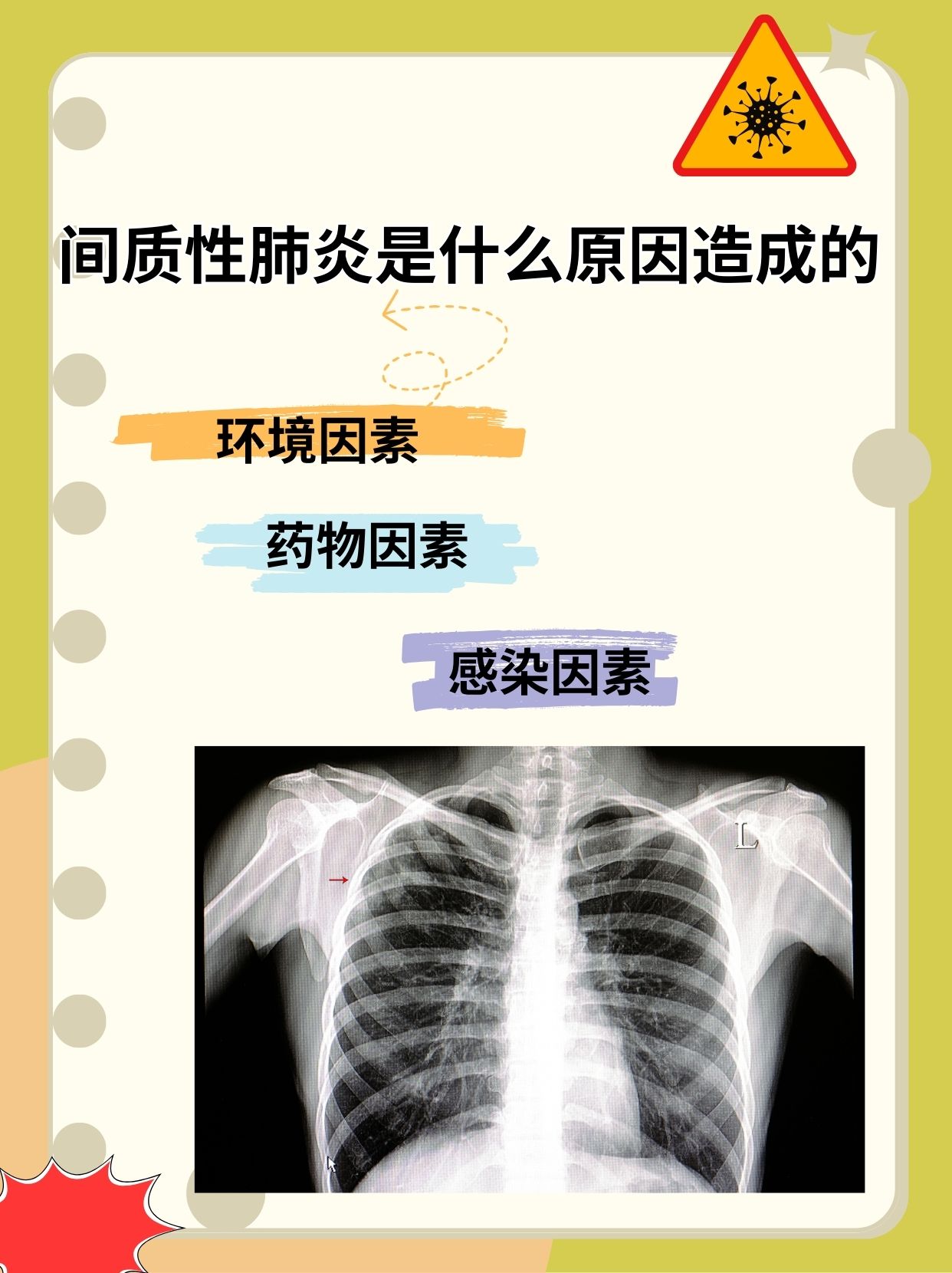 “2019年新型肺炎爆发” 2019新型肺炎叫什么名字？-第2张图片