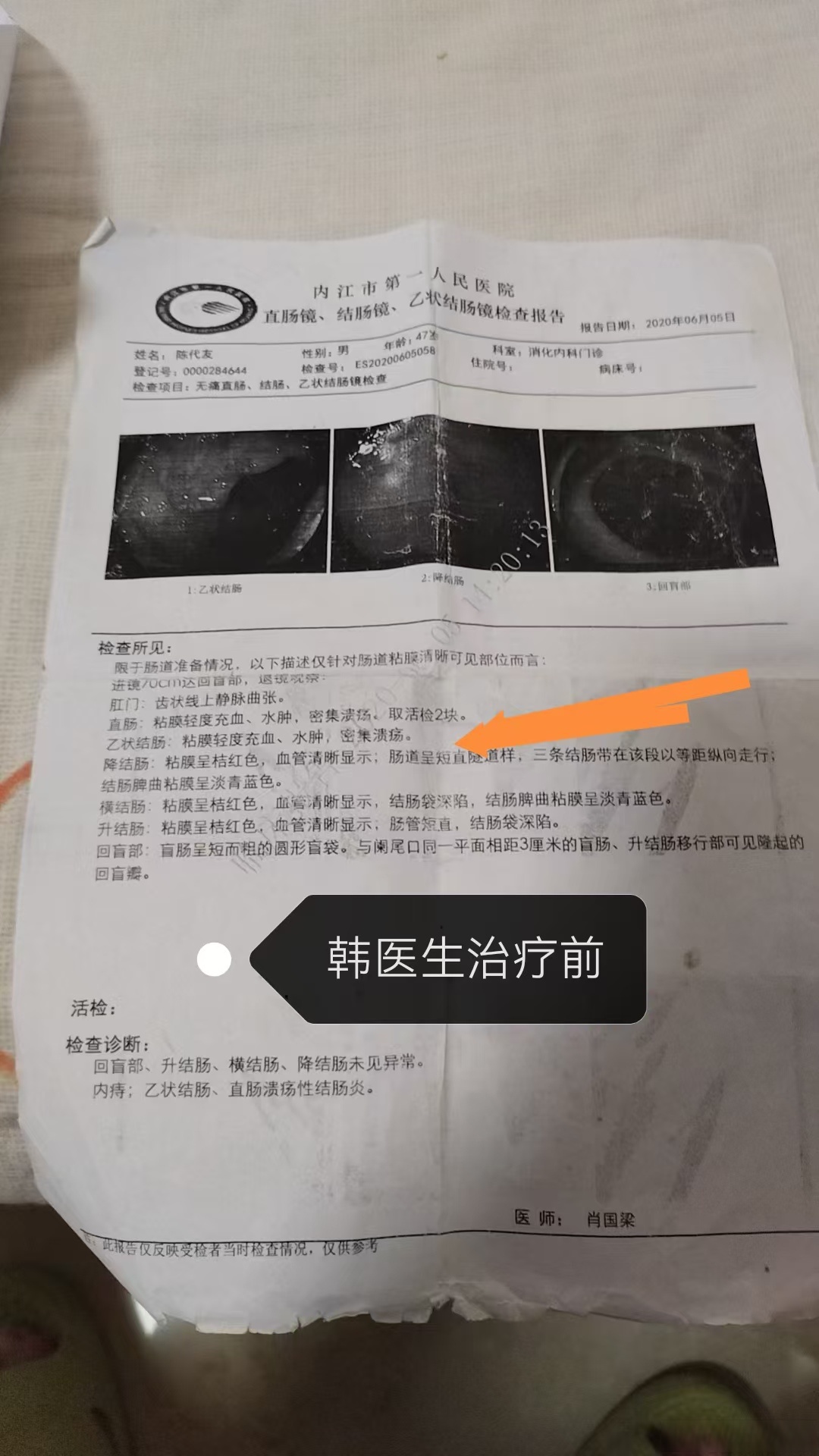 贵州新增2例本土确诊病例.贵州新增1例-第3张图片