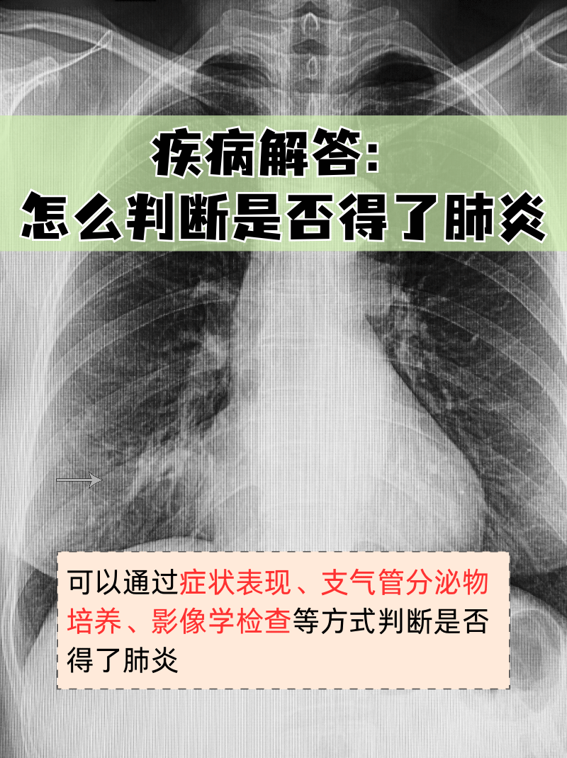“肺炎今天新闻最新” 今天肺炎新消息？-第3张图片