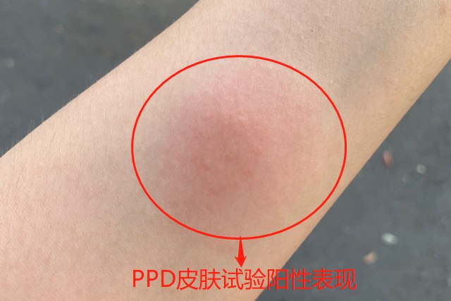 扬州1例阳性人员前10次检测均阴性.扬州 阳性-第1张图片