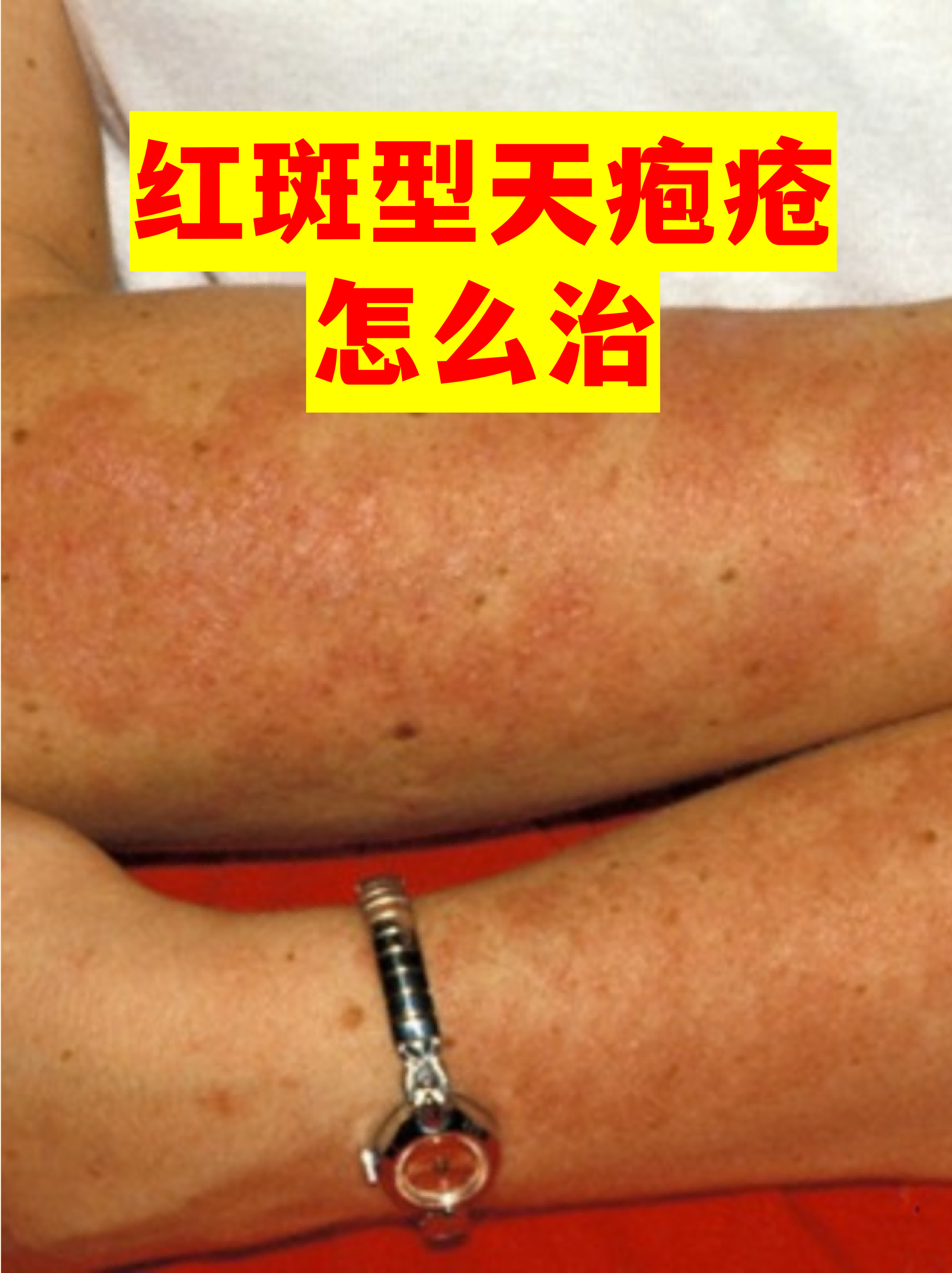 “四川新增省内感染者30例” 四川新增感染者的症状？-第1张图片