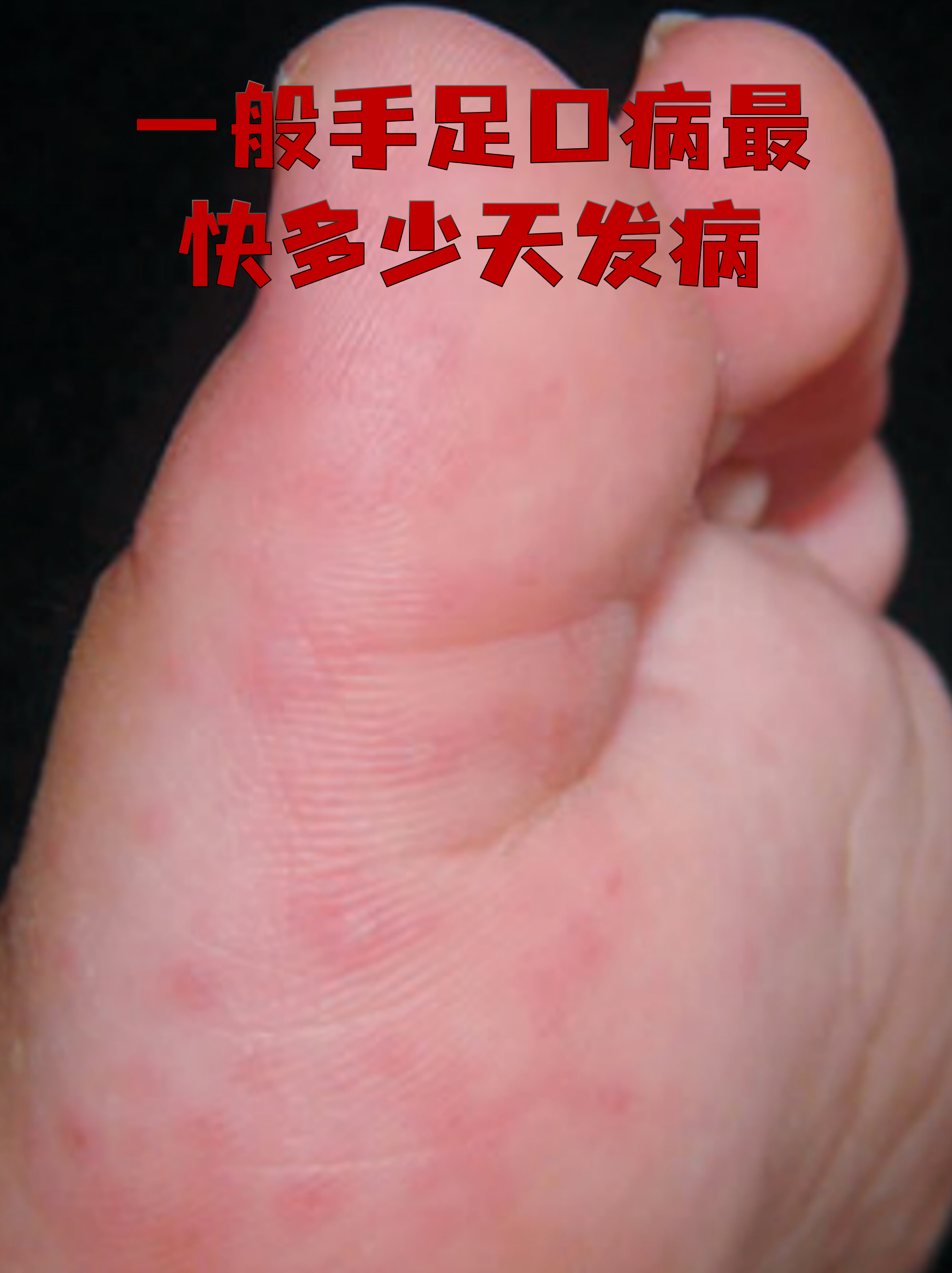 「哈尔滨新增4例无症状感染者」〃哈尔滨新增3例无症状感染者-第1张图片