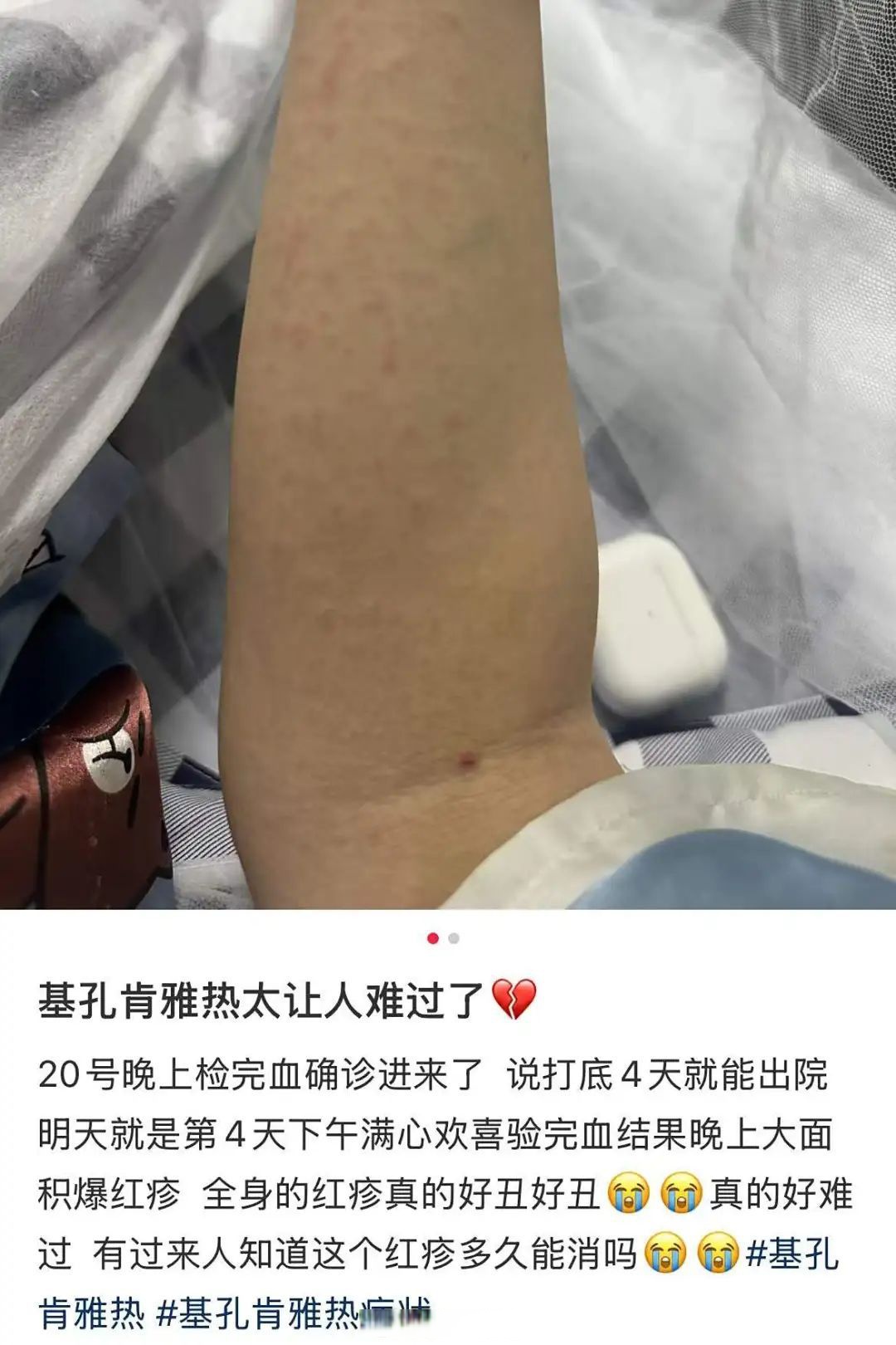 “31个省份新增确诊病例17例	” 31个省新增确诊病例30例？-第1张图片