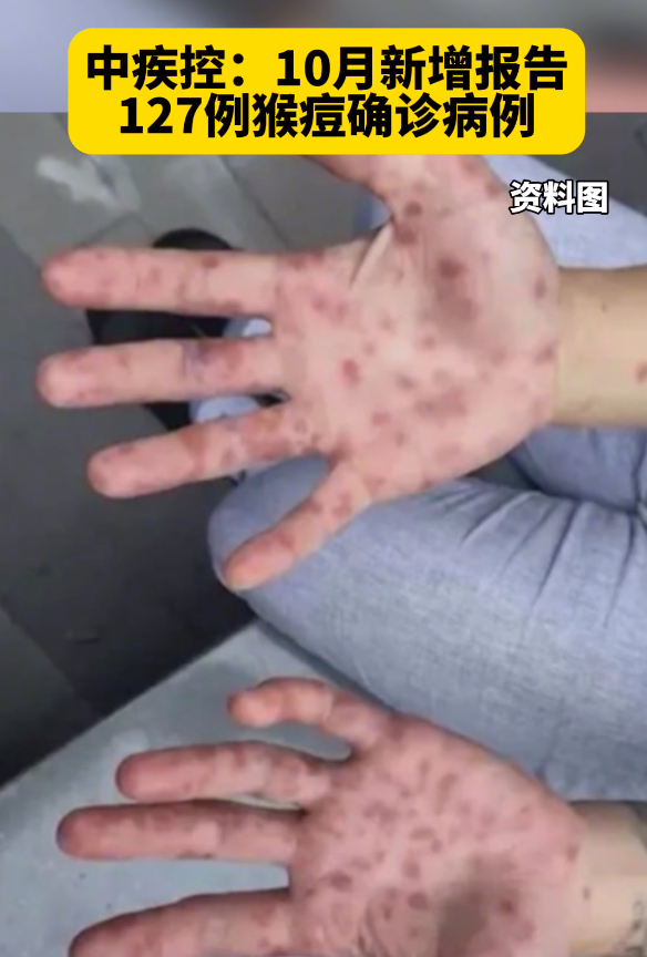 “湖北新增本土无症状11例” 湖北新增无症状感染者15例？-第1张图片