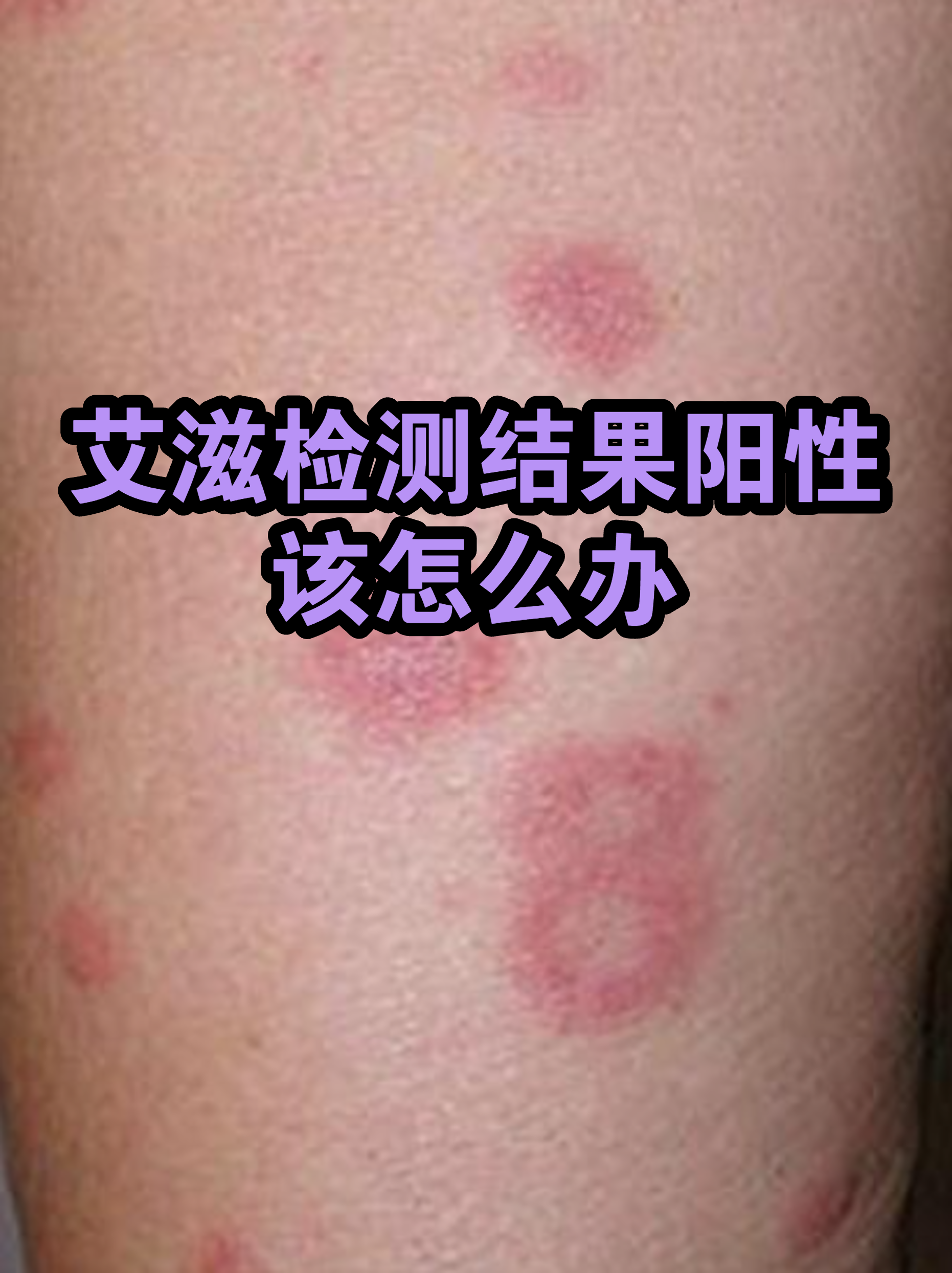 “江苏无锡发现31名阳性人员	” 无锡确诊阳性？-第1张图片