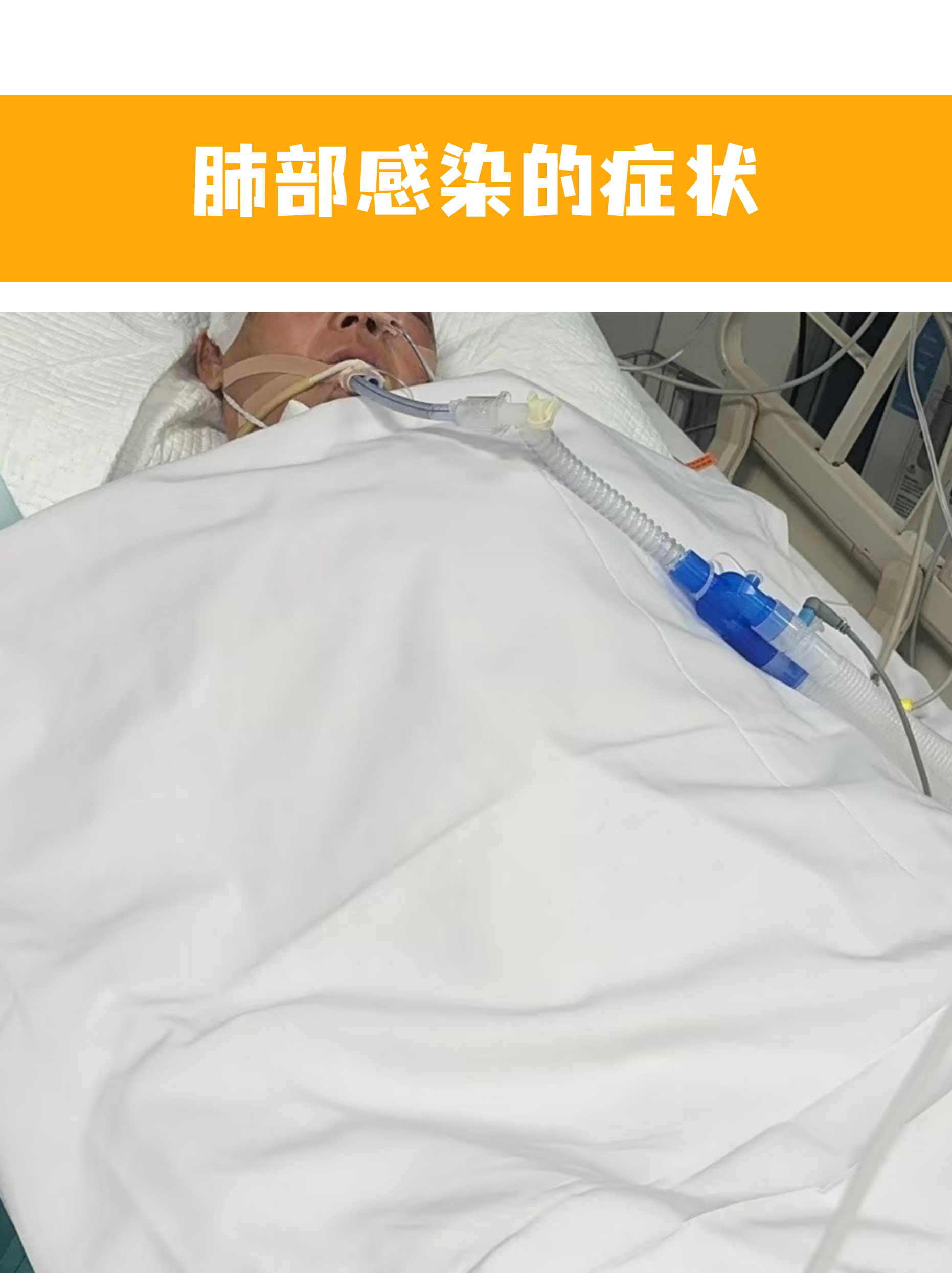北京顺义新增1例无症状.北京顺义新增1例肺炎-第1张图片